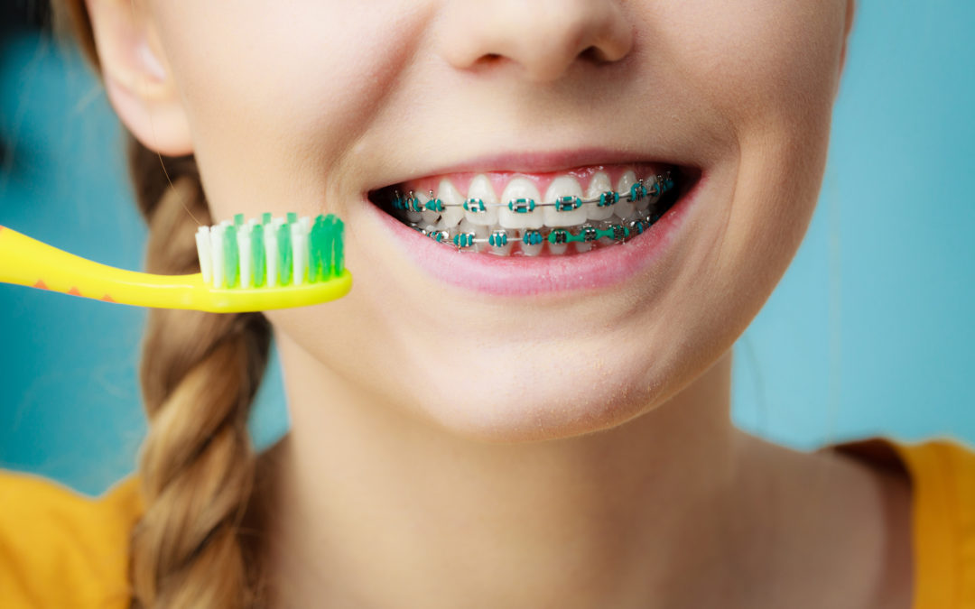 Invisalign vs. Traditional Braces: Which Is Better for Your Child?